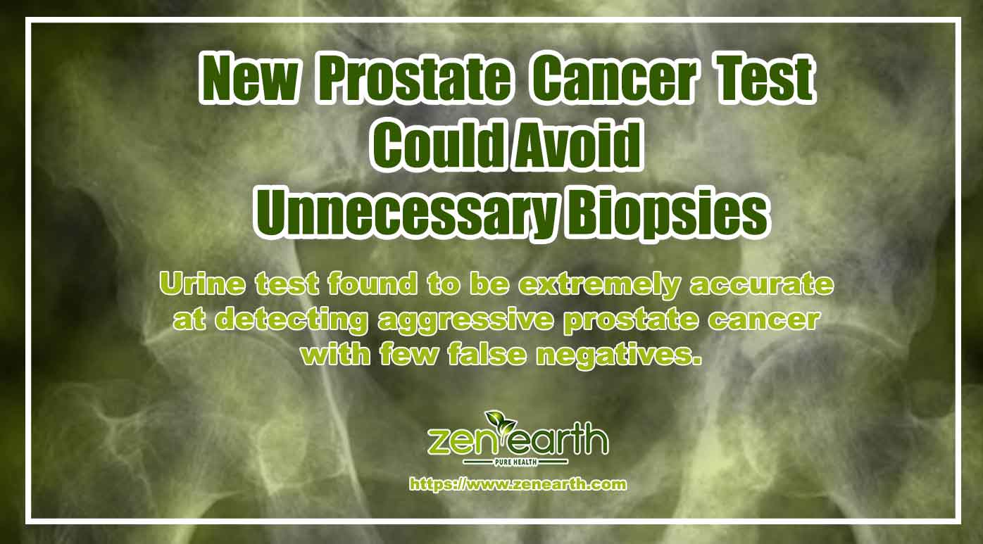 New-Prostate-Cancer-Test-Could-Avoid-Unnecessary-Biopsies