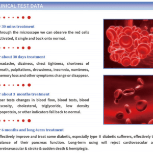 Redlight Laser Watch Acupuncture